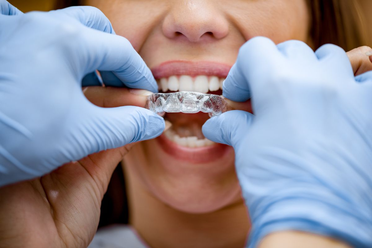 Why invisible braces better than metal braces
