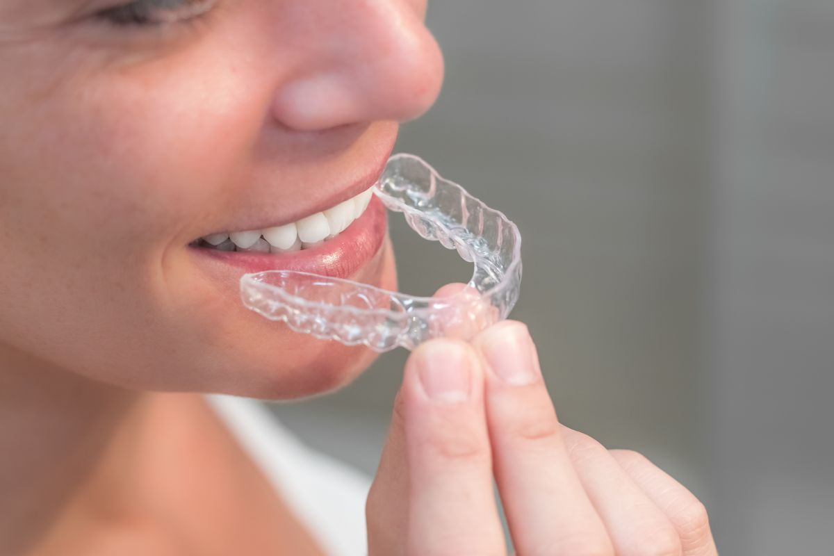 Choosing the Right Orthodontic Treatment for You