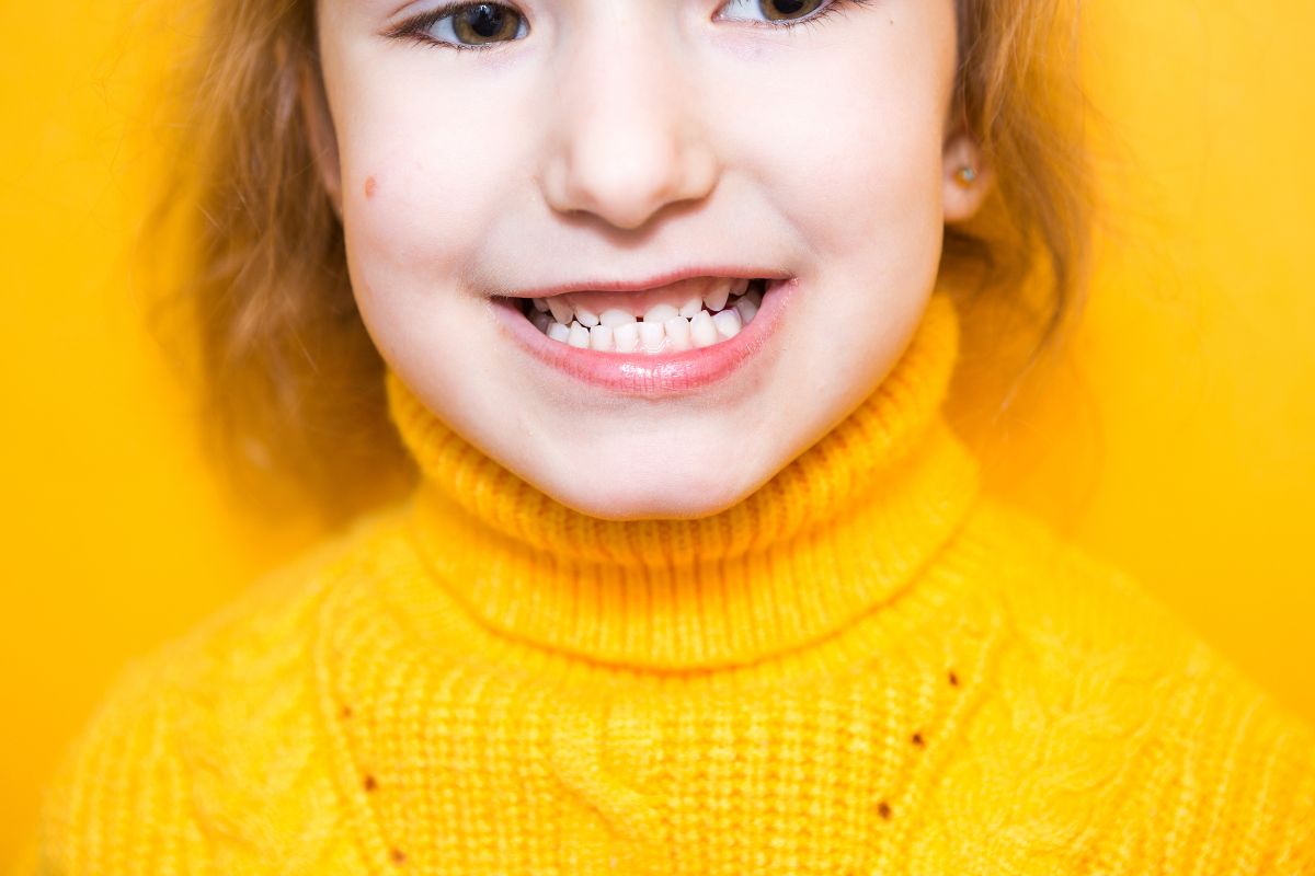 The role of clear removable braces in correcting overbite, underbite, and crossbite