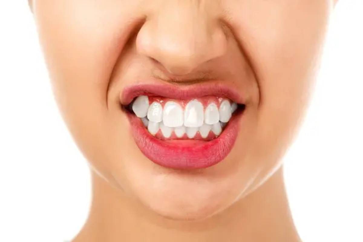 Teeth-Grinding-Image